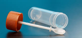 Skúmavka na odber stolice 1ks